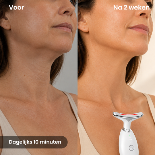 Sculptiq™ Pro LED Device — Professionele lifting voor nek en gezicht, thuis in 10 minuten